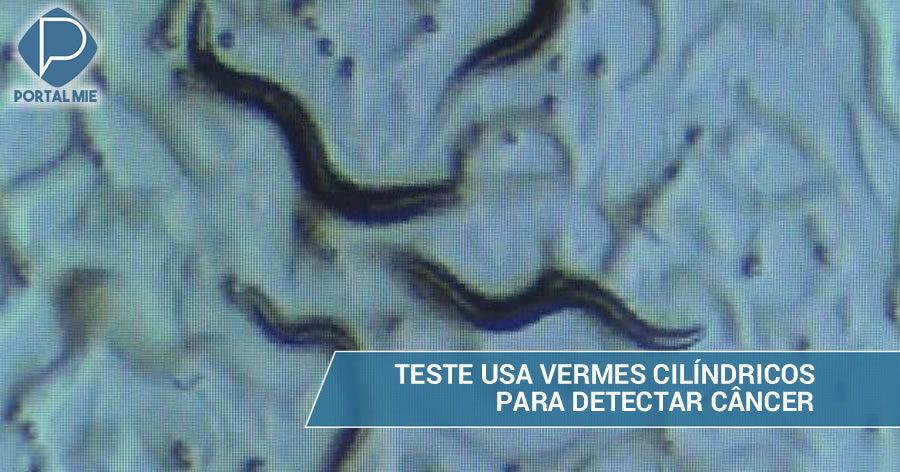 Empresa japonesa lança kit de teste que usa vermes cilíndricos para ...