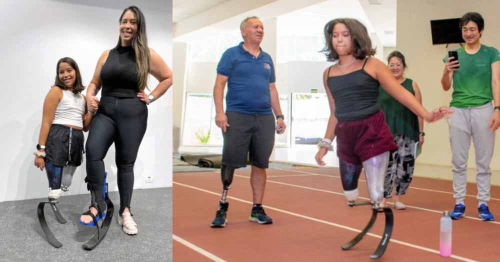 engenheiro japones transforma a vida de menina com proteses destaque 1